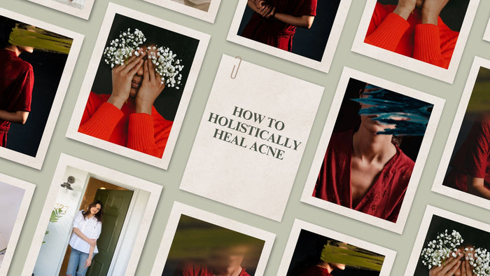 How To Holistically Heal Acne